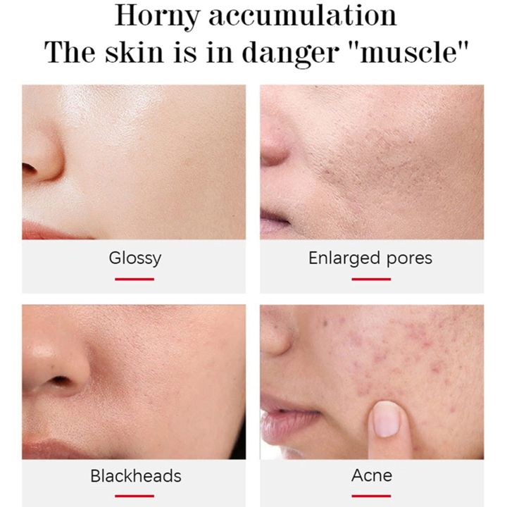 Aichun%20beauty%2024k%20pure%20gold%20peeling%20gel%20for%20face%20&%20body%20100%20ML%20-%20Image%206