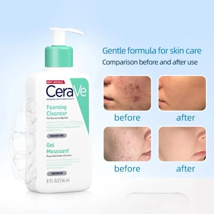 CeraVe%20Skincare%20Products%20C%20Serum%20Acne%20Control%20Hydrating%20Foaming%20SA%20Cleanser%20Smoothing%20AM%20PM%20Lotion%20All%20Skin%20Types%20Moisturising%20-%20Image%208