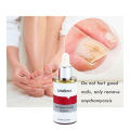 LANBENA Nail Repair Essence Serum Fungus Treatment Nail Removal Onychomycosis-15ml. 