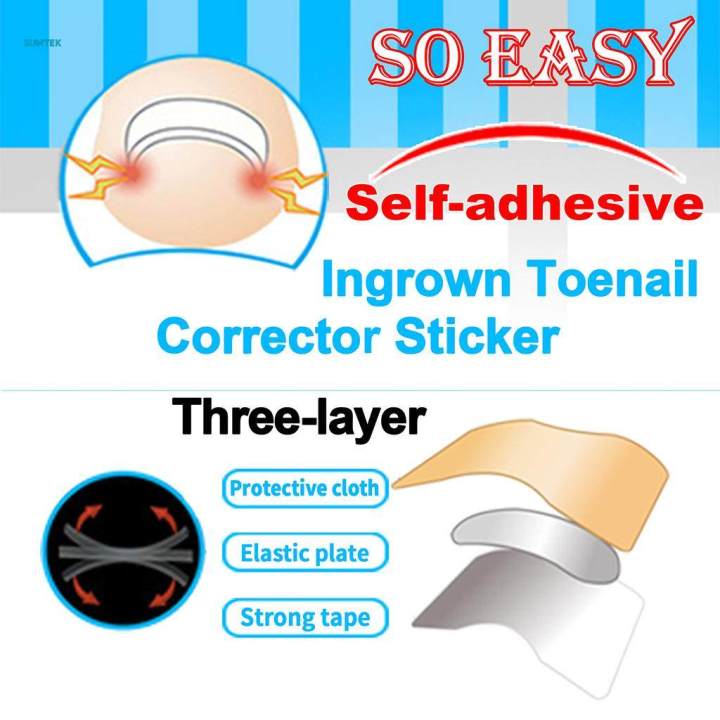 %E3%80%90Top-rated%E3%80%91%20Toenail%20Corrector%20Stickers,%20Toe%20Nail%20Treatment%20Toe%20Nail%20Care%20Correction%20Tool%20-%2050%20Sheets%20-%20Image%206