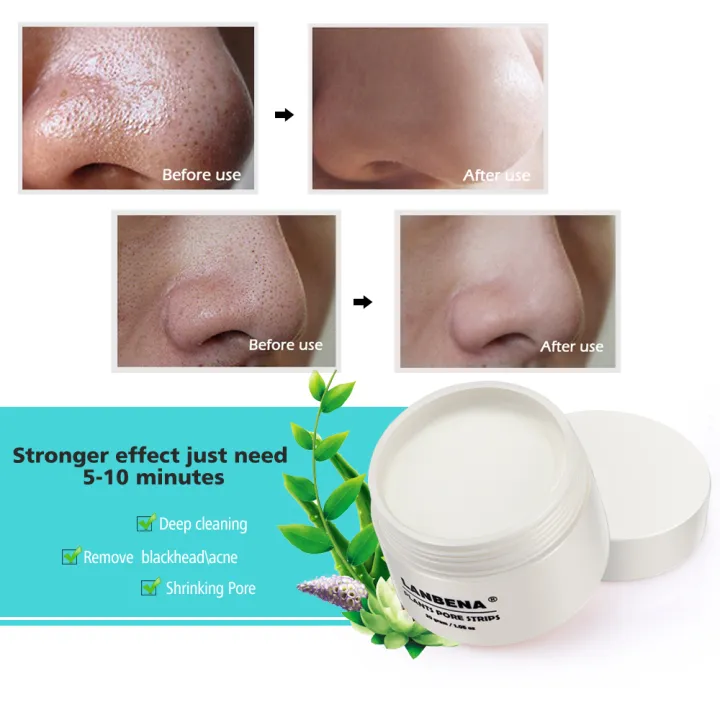 30g%20Blackhead%20Remover%20Cream%20Paper%20Plant%20Pore%20Strips%20Nose%20Acne%20Cleansing%20Black%20Dots%20Peel%20Off%20Mud%20Mask%20Treatments%20Skin%20Care%201-5pcs%20-%20Image%204