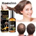 【Good-Love Store】(New) hair essence high saturation anti hair loss essential oil. 