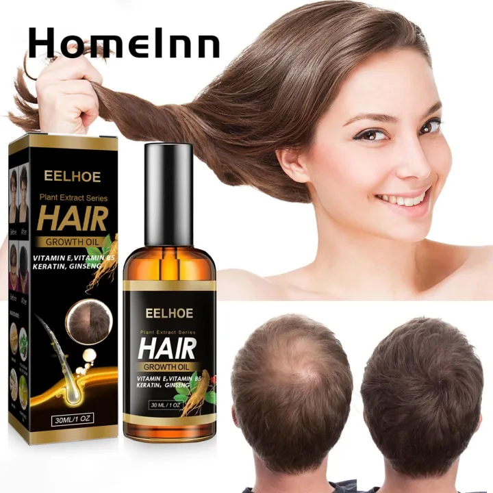 %E3%80%90Good-Love%20Store%E3%80%91(New)%20hair%20essence%20high%20saturation%20anti%20hair%20loss%20essential%20oil%20-%20Image%202