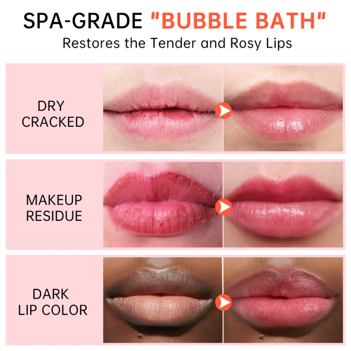 JoyPretty%20Bubble%20Lip%20Balm%20Lightening%20Dark%20Lip%20Mask%20Gloss%20Oil%20Makeup%20Exfoliating%20Clean%20Moisturizer%20Beauty%20Health%20Lip%20Care%20Product%20BruberryBeE%20-%20Image%202