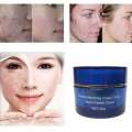 International Japanese Products Anti Freckles  Cream 25m. 