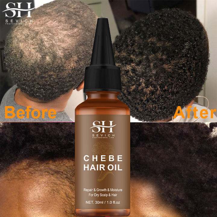 Sevich Africa Hair Growth Oil 30ml Traction Alopecia Chebe Powder Essence Oil Anti Hair Loss Treatment Product Thicken Hair Care AOutlierA