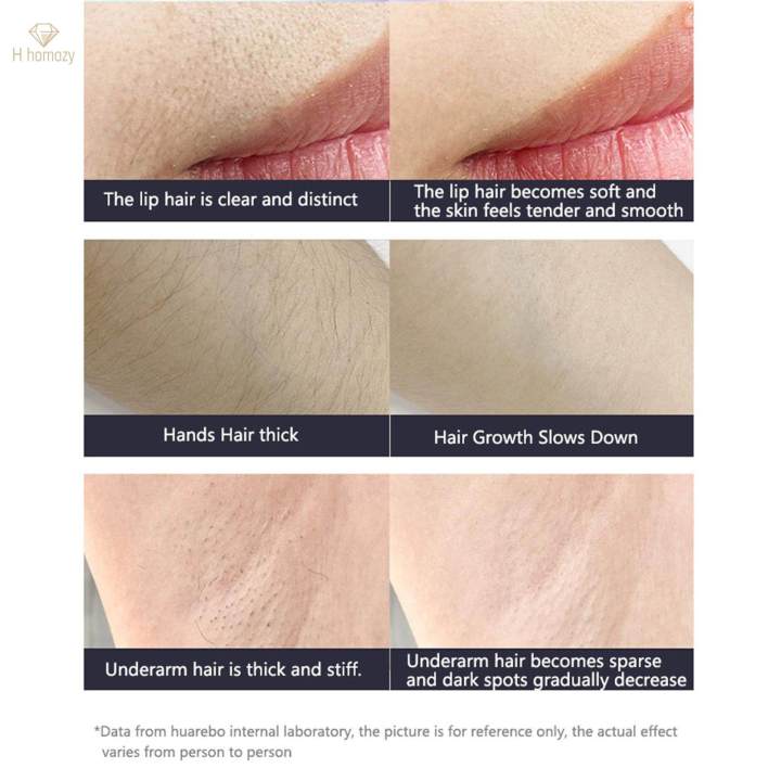 Laser%20Permanent%20Laser%20Hair%20Remover%20for%20Whole%20Body%20-%20Image%204