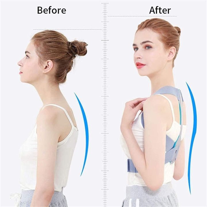 Back%20Support%20Posture%20Corrector%20Clavicle%20Spine%20Shoulder%20Support%20Belt%20Back%20Pain%20Relief%20Posture%20Correction,%20Improves%20Humpback,%20Clavicle%20Support%20Student/Adults/Unisex%20brbr,Posture%20Corrector%20Comfortable%20-%20Image%205