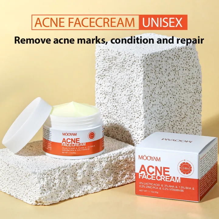 Acne%20Treatment%20Cream%20Anti%20Acne%20Face%20Cream%20Pimple%20Removal%20Spots%20Oil%20Control%20Shrink%20Pores%20Moisturizing%20Skin%20Care%20Cream%20-%20Image%203