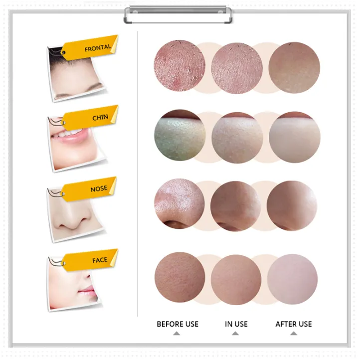 %E3%80%BD%EF%B8%8F%20BIOAQUA%20Black%20Mask%20Activated%20Carbon%20Charcoal%20Peel-Off%20Mask%20%E2%80%93%20Deep%20Pore%20Cleansing,%20Blackhead%20Remover,%20Oil%20Control%2060g%20-%20Image%206