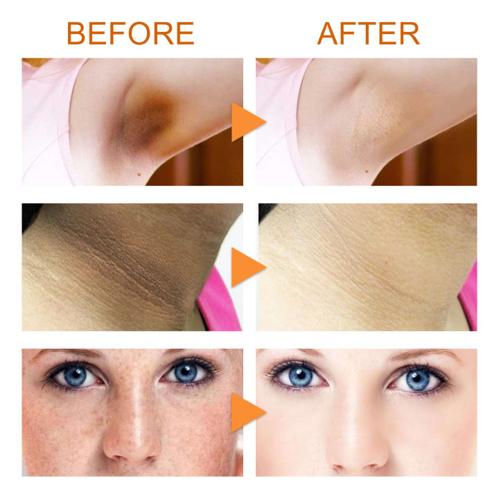 Vitamin%20C%20Whitening%20Soap%20Deep%20Cleansing%20Dark%20Spot%20Remover%20Body%20Fade%20Melanin%20Moisturizing%20Brighten%20Lightening%20Bleaching%20Soap%20100g%20-%20Image%206
