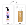 skin'O Anti Dandruff Treatment Shampoo - 200ml to all hair type. 