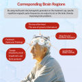 Dawfek rTMS for Anxiety Home Remedy Anxiety Depression Management of Bipolar I Disorder Transmagnetic Stimulation Machine rTMS.