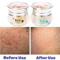 Feique Rose Essence Anti-freck Day and Night Cream. 