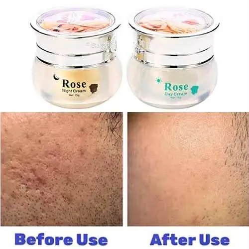 Feique%20Rose%20Essence%20Anti-freck%20Day%20and%20Night%20Cream%20-%20Image%204