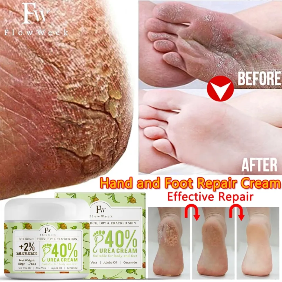 Urea Anti Drying Foot Cream Crack Heel Cream Removal Feet Calluses - Main Image