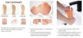 Silicone Heel Pad Anti Crack Set (Free Size) 2 piceces.