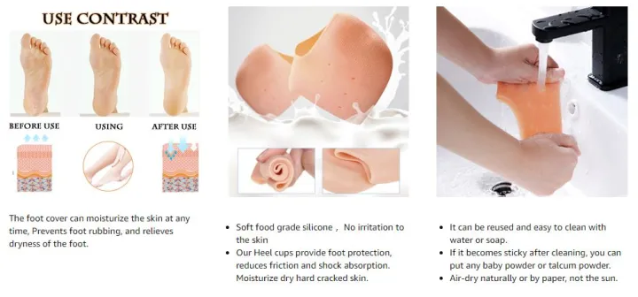 Silicone%20Heel%20Pad%20Anti%20Crack%20Set%20(Free%20Size)%202%20piceces%20-%20Image%204