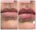 WishCare Tinted Ceramide Lip Balm with SPF50 PA+++ - Kojic Acid & Niacinamide - For Lip Lightening & Protection 5gm. 
