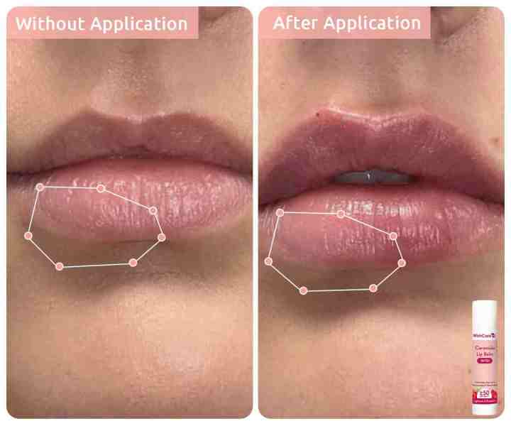 WishCare%20Tinted%20Ceramide%20Lip%20Balm%20with%20SPF50%20PA+++%20-%20Kojic%20Acid%20&%20Niacinamide%20-%20For%20Lip%20Lightening%20&%20Protection%205gm%20-%20Image%205