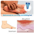 10PCs suifun diabetes foot cream skin ulcer ointment pain relief anti infection crack diabetic accessories Chinese medicine.