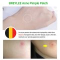 【DIV MALL】Patch Pimple Stickers Pimple Remover Spot Facial Mask. 