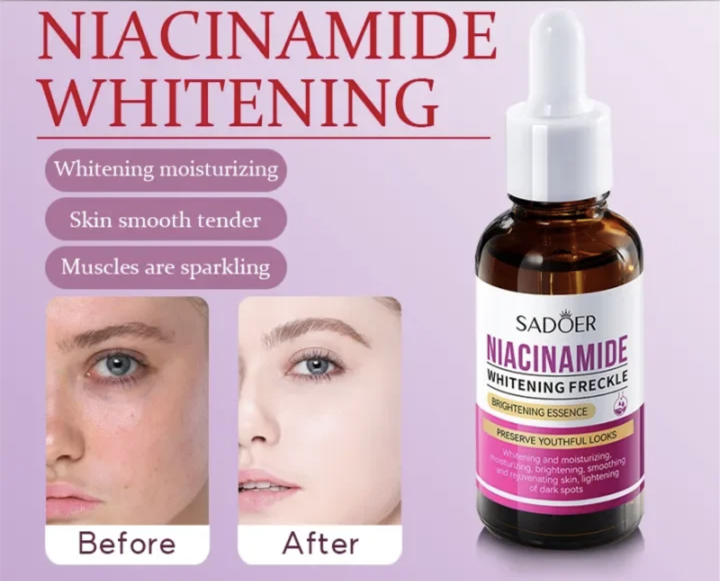 SADOER%20Niacinamide%20Whitening%20Anti-Freckle%20Face%20Serum,%20Black%20Spot%20Remover%20and%20Skin%20Moisturizer%20with%20Repair%20&%20Brightening%20Face%20Essence%20-%20Image%202