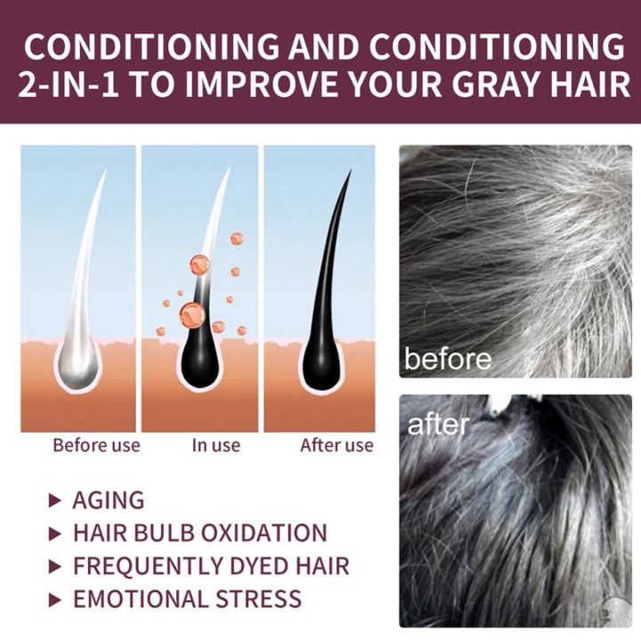 South%20Moon%20Rice%20Shampoo%20Soap%20Korea%20Polygonum%20Darkening%20Root%20Scalp%20Deep%20Clean%20Anti%20Loss%20Prevent%20Hair%20Color%20Restore%20Nourishing%20Care%20Polygonum%20Soap%20Anti%20Hair%20Loss%20Bar%20Restore%20Nutrition%20Regrowth%20White%20To%20Black%20Solid%20Shampoo%20-%20Image%206