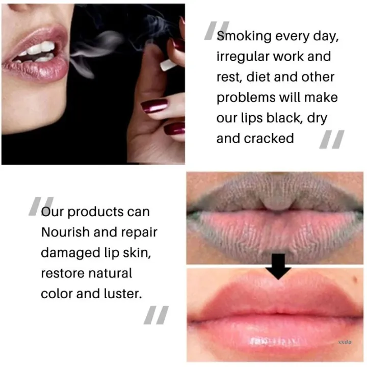 Lip%20Black%20Removal%20Lip%20Balm%20Eliminates%20Uneven%20Dark%20Spots%20on%20the%20Lips%20Treatment%20-%20Image%204