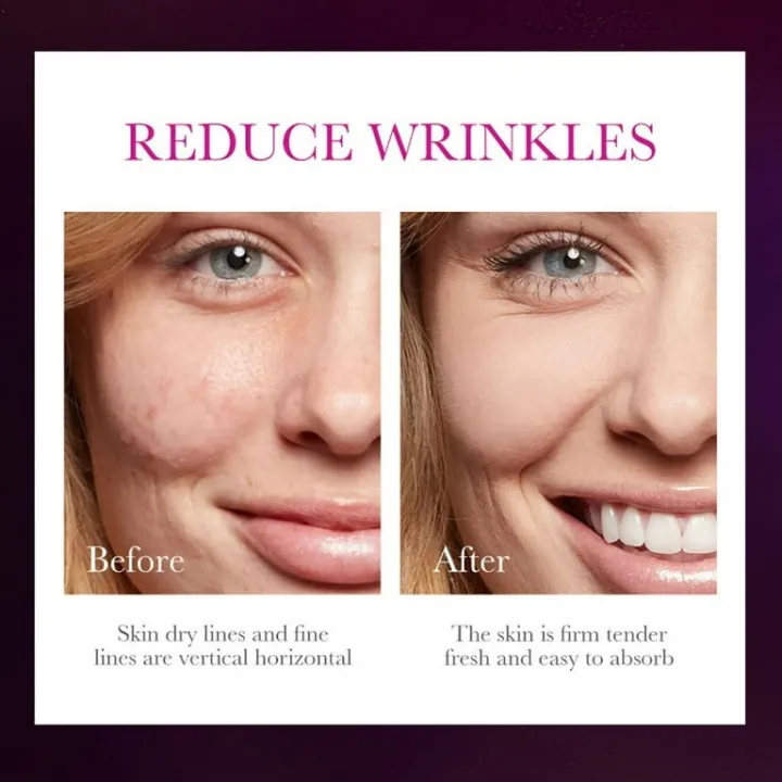 SADOER%20Snail%20Reorganize%20Collagen%20Face%20Sheet%20Mask-%2025g%20-%20Image%204