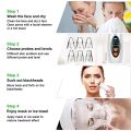 Rechargeable Electric Blackhead Remover Device.