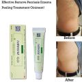 (New) zudaifu antibacterial ointment creams Psoriasis Eczema peeling herbal cream beige & Green. 