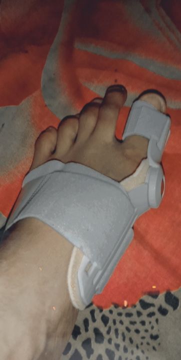 Bunion%20Splint%20Big%20Toe%20Straightener%20Corrector%20Foot%20Pain%20Relief%20Hallux%20Valgus%20Correction%20Orthopedic%20Supplies%20Pedicure%20Foot%20Care%20-%20Image%204