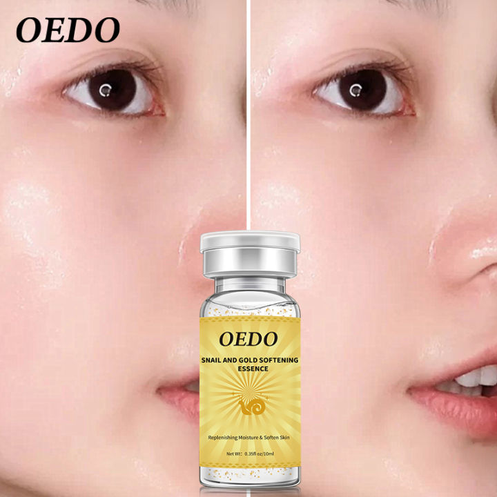 OEDO%20Anti-Aging%20Snail%20and%20Gold%20Essence%20Hydrating%20Hyaluronic%20Acid%20Moisturizers%20Treatment%20Face%20Care%20Cream%20Serum%20Snail%20Pure%20Extract%20-%20Image%204