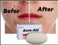 Stiefel acne-aid - 100g pimple prone and oily skin soap. 