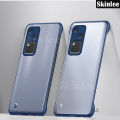 Phone Case For vivo V30 Pro Flip Back Cover Thin Frameless Case Clear Matte Rimless Radiating For vivo V30 Cover Cases.