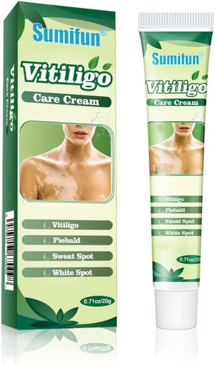 Sumifun Vitiligo Care Cream, Vitiligo Treatment, Reduces White Spots on Skin, Pigmentation regulating 20G