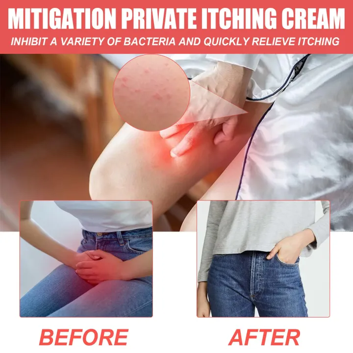 Private%20Antipruritic%20Cream%20Remove%20Odor%20Vaginitis%20Relief%20Redness%20Pain%20Genital%20Pruritus%20Dermatitis%20Vaginal%20Antibacterial%20Care%2020g%20-%20Image%204