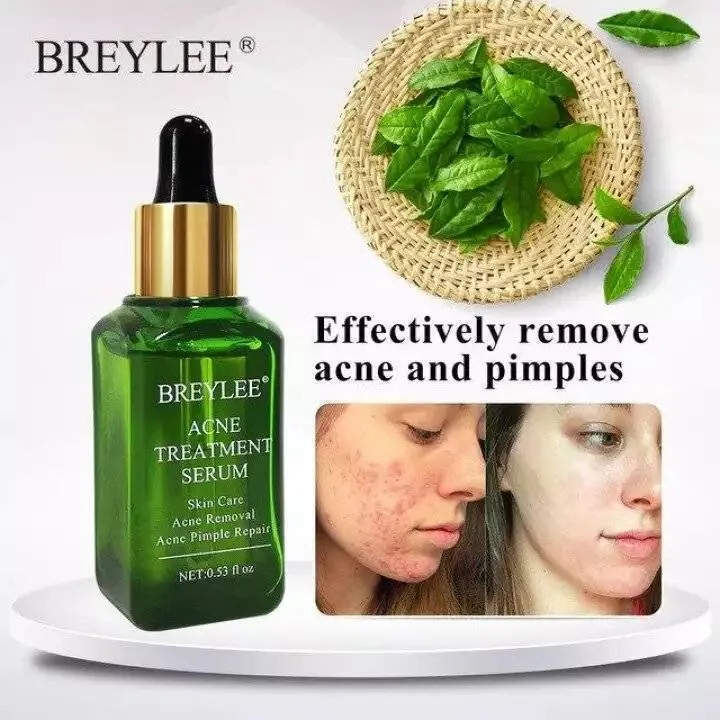 BREYLEE%20Acne%20Treatment%20Cream%20and%20Serum(%2020g%20+17ml)-Acne%20Combo%20-%20Image%202