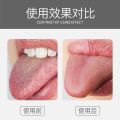 Tongue Scraper Cleaner for Adults Double-sided tongue scraper. 