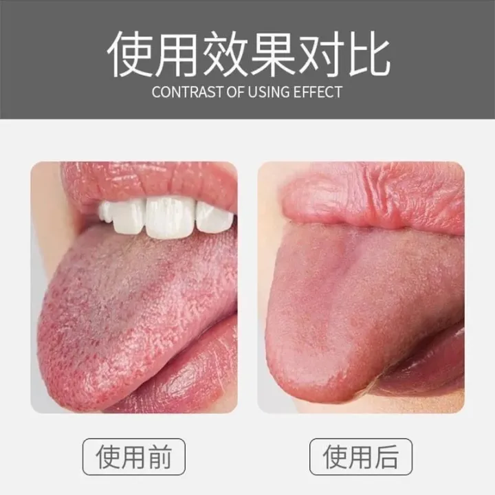 Tongue%20Scraper%20Cleaner%20for%20Adults%20Double-sided%20tongue%20scraper%20-%20Image%204