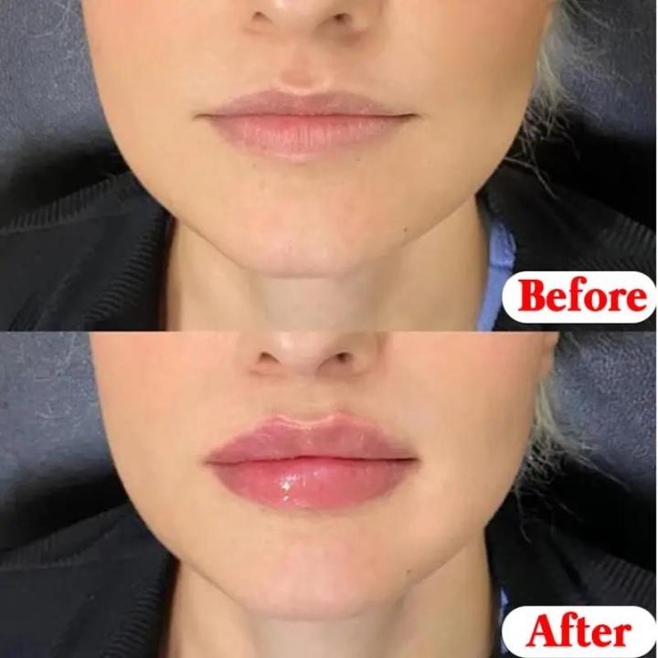 4-8pcs%20Fruit%20Series%20Lip%20Gloss%20Set%20Lip%20Balm%20Set%20Moisturizing%20Refreshing%20Non-sticky%20Anti-Cracked%20Lip%20Treatment%20Vaseline%20for%20Makeup%20-%20Image%202