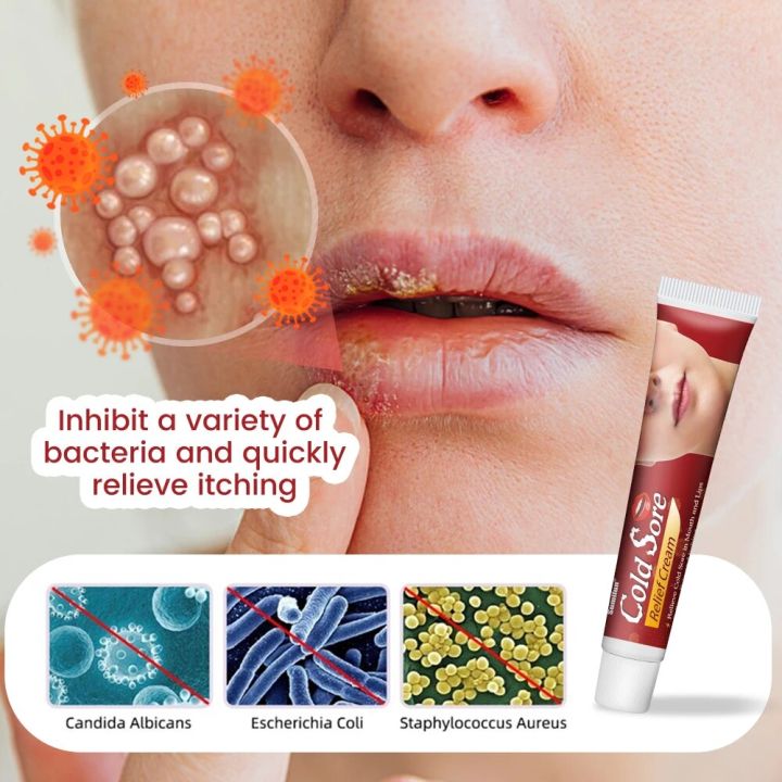 20g Cold Sores Lip Care Cream Repair Cheilitis Lips Herpes Ulceration Antibacterial Ointment Moisturizing Lip Balm