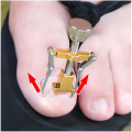 Details about New Pro Ingrown Toe Nail Recover Toenail Correction Pedicure Fixer. 