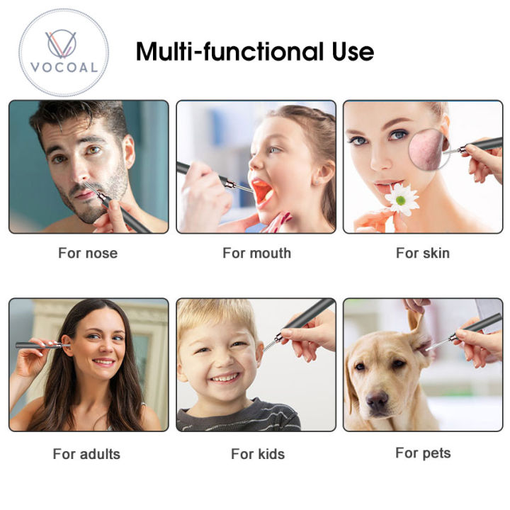 Vocoal%20Ear%20Pick%20Intelligent%20Visible%20Ear%20Spoon%20Ear%20Wax%20Removal%20Ear%20Cleaner%20with%20Camera%20Visual%20Ear%20Scope%20Camera%20Safe%20Ear%20Pick%20Ear%20Cleaning%20Endocsope%20Kit%20%20Wireless%20Ear%20Otoscope%20Ear%20Cleaning%20Tool%20for%20iPhone%20%20iPad%20&%20Android%20Smart%20Phones%20-%20Image%207