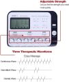 6 Output Channel Disgistal Multi-Functional TENS Body Massager Electric Muscle Stimulator Relax Electroacupuncture Patch Massage.