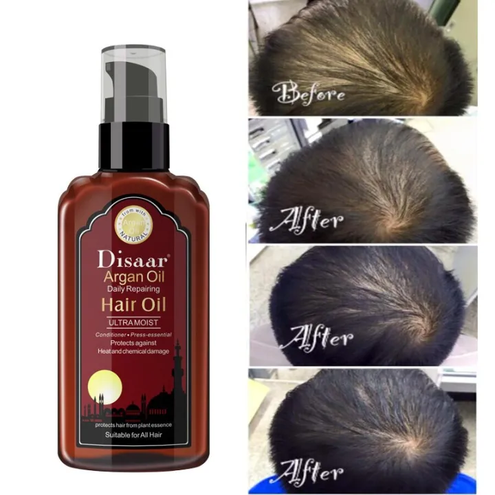 Hair%20Growth%20Essential%20Oil%20Argan%20Oil%20Nourish%20Scalp%20Repair%20Dry%20Damage%20Hair%20Treatment%20Nursing%20Glycerol%20Hairdressing%20Hair%20Care%20120ml%20-%20Image%205