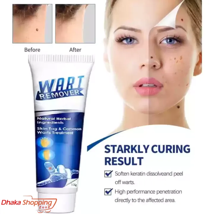 Warts%20Remover%20Ointment%20Wart%20Treatment%20Cream%20Skin%20Tag%20Remover%20Ointment%20-%20Face%20-%20Sara%20Enterprise%20BD%20-%20Image%204