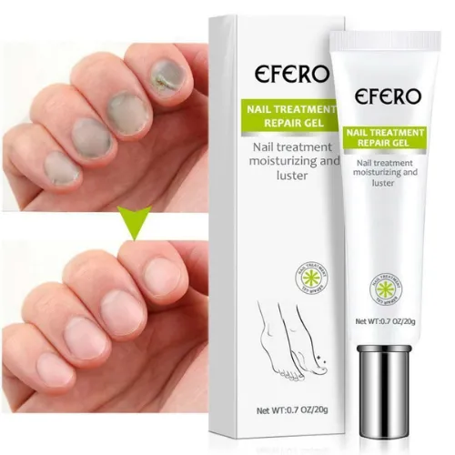 Efero%20Nail%20Repair%20Treatment%20Gel%20Fungus%20Cream-20gm%20%20Bix%20super%20shop%20-%20Image%205
