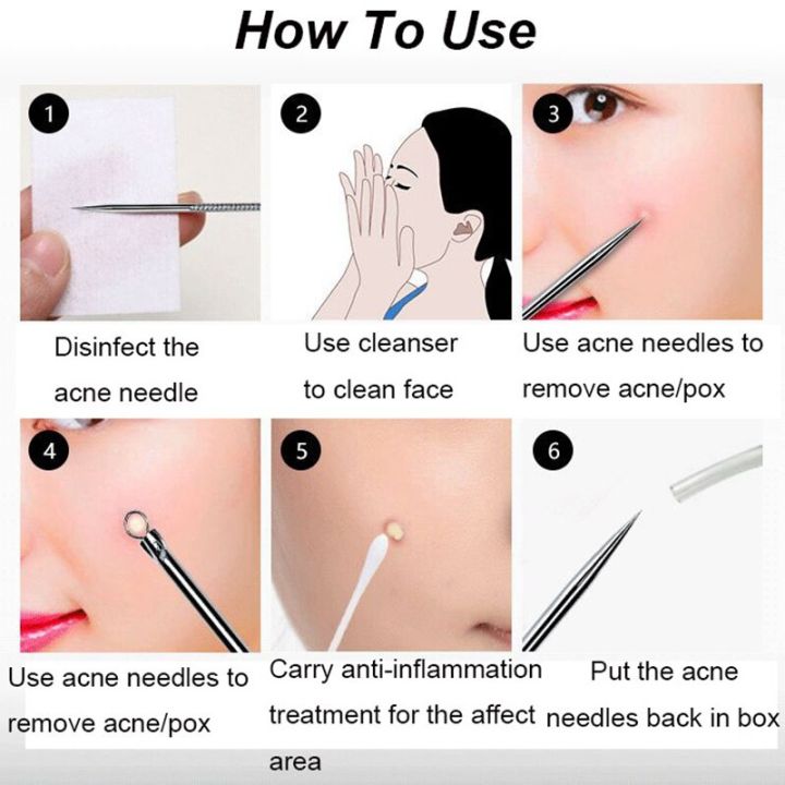4pcs/set%20Blackhead%20Comedone%20Pimple%20Blackhead%20Remover%20Tool%20Spoon%20for%20Face%20Skin%20Care%20Tool%20Acne%20Removal%20Needles%20Facial%20Pore%20Cleaner%20-%20Image%208